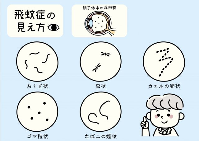 飛蚊症の見え方