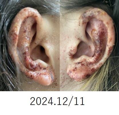 before画像